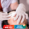 Nặn tuyến bờ mi, đánh bờ mi (Chuyên sâu)