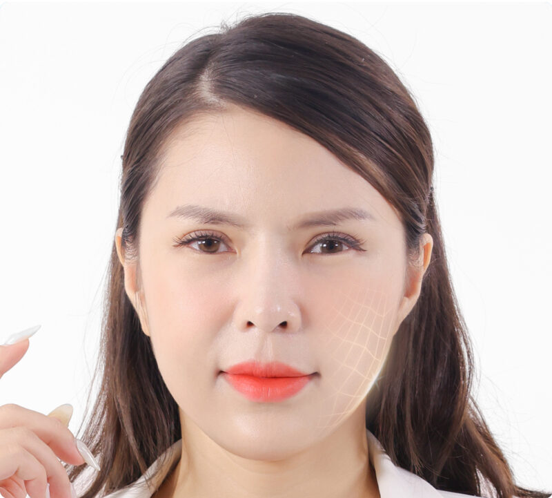 DEAL GIÁ TỐT - Cấy mỡ tạo hình mặt (*)