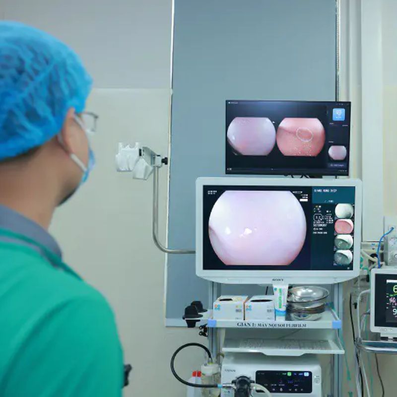 Gói khám nội soi kép mê và ung thư tiêu hoá chuyên sâu