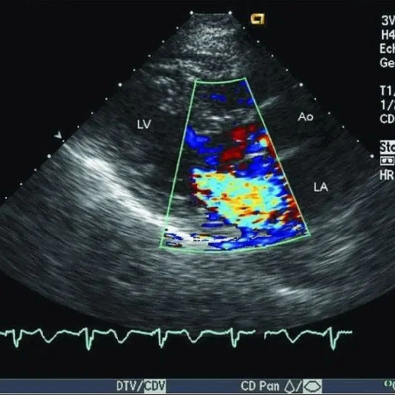 E-voucher siêu âm tim Doppler (Nhi)