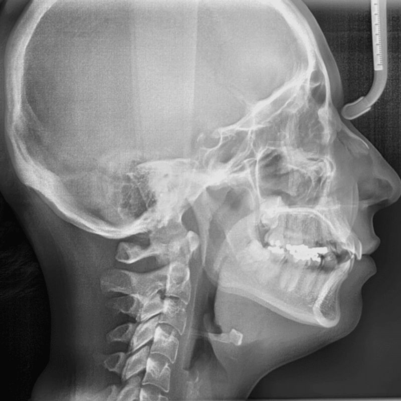 chụp xquang 1 khớp