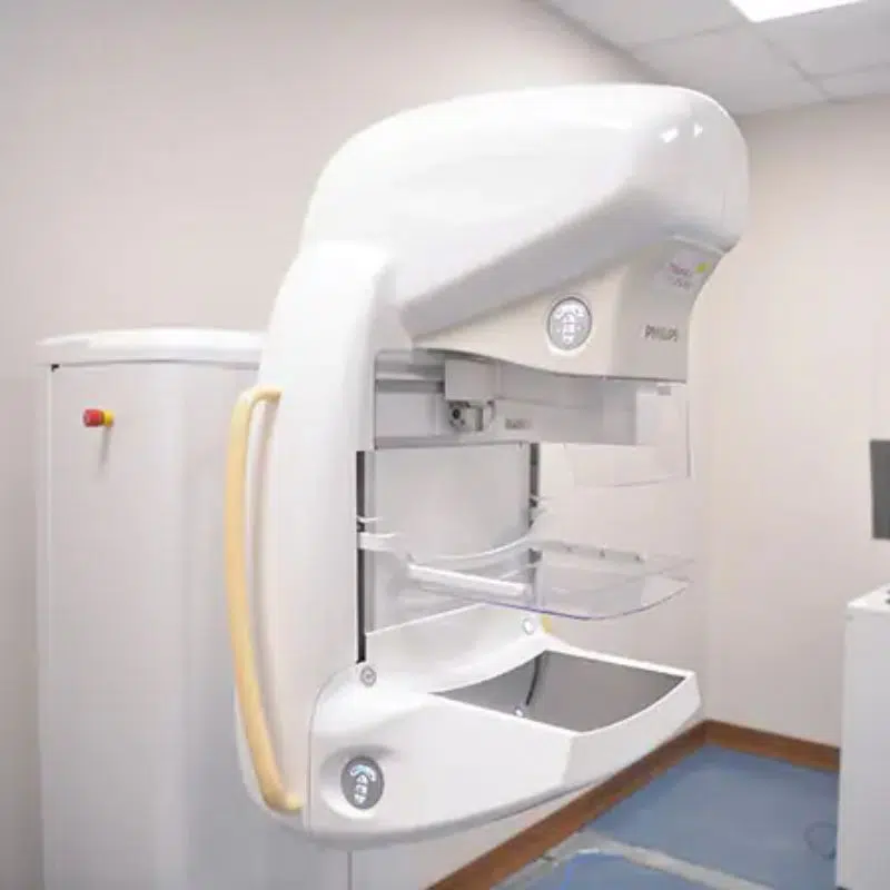 chụp xquang 1 khớp